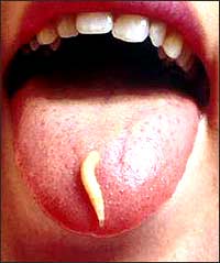 A person with a maggot on the end of their tongue.